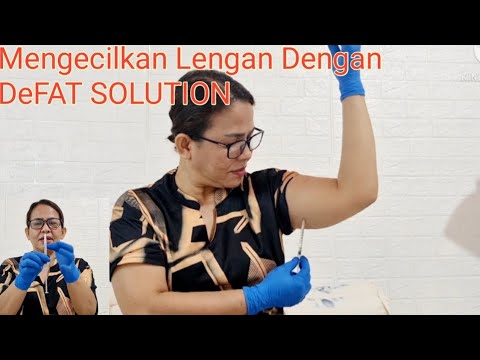 DeFAT SOLUTION || Suntik Lemak Lengan Sendiri ( @Bunda Yuni )