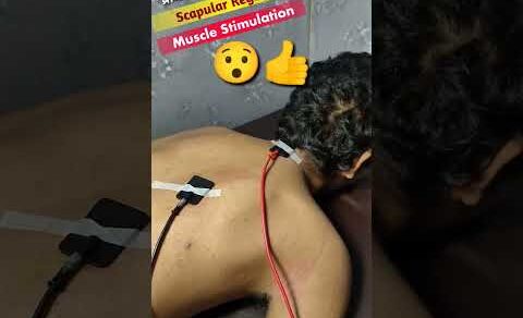 Muscle Stimulation Kya Hota Hai || #shorts #physiodrdeepaksoni