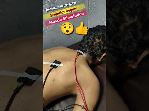 Muscle Stimulation Kya Hota Hai || #shorts #physiodrdeepaksoni